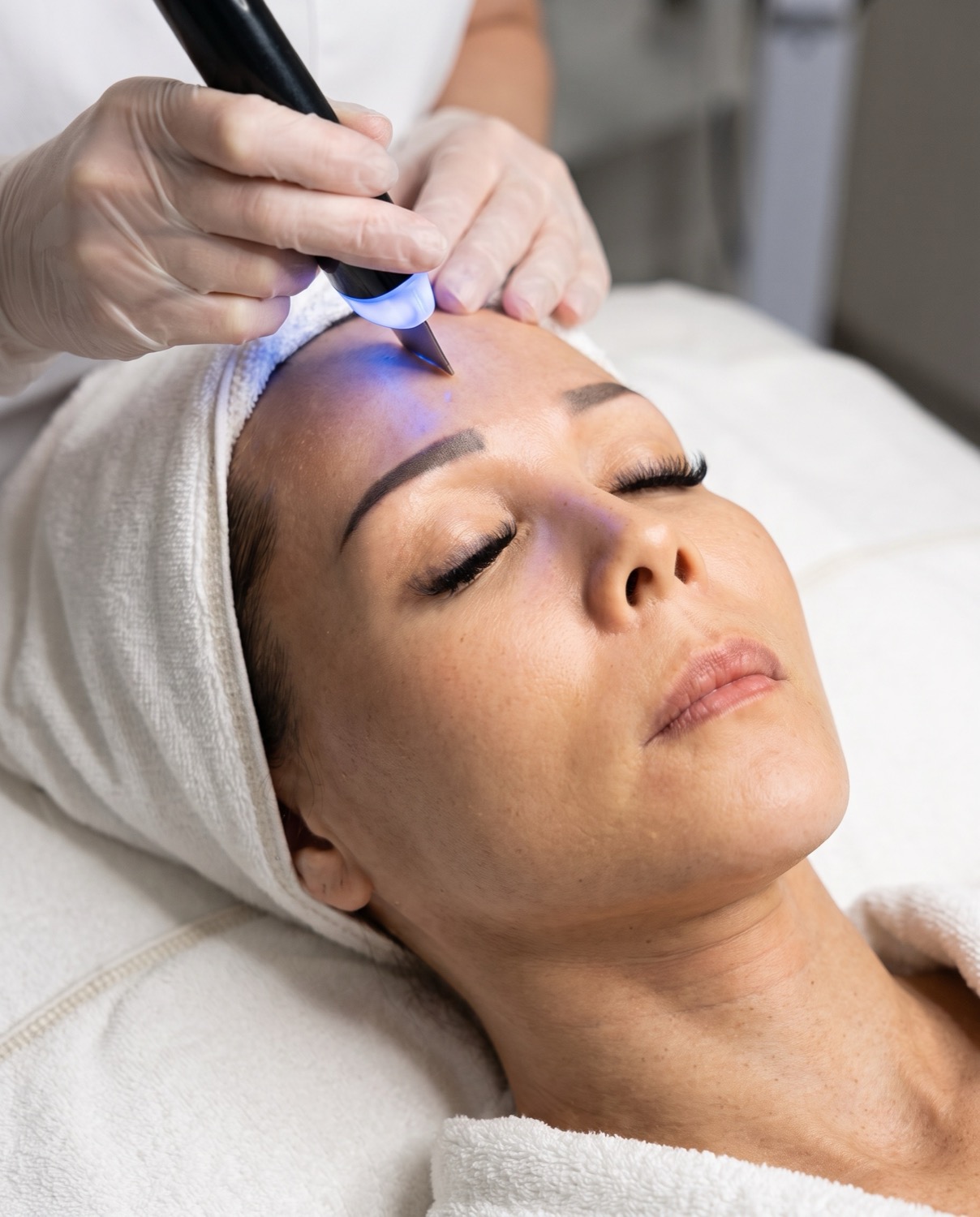Therapist using a cold light wand during Collagen Lifting